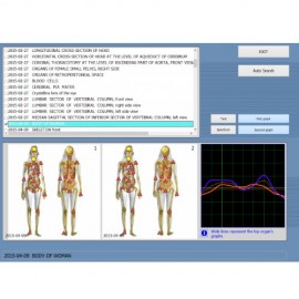 GY-518D Biyo Rezonans 8D NLS / 9D NLS Üstün Versiyonlu Vücut Sağlığı Analiz Cihazı