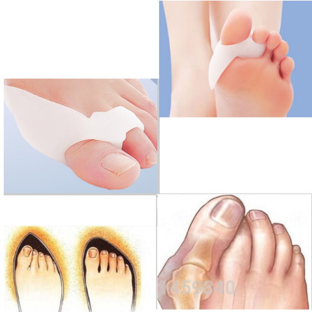 Slikon Bunion Ayak parmak Koruyucu (1Çift) S002