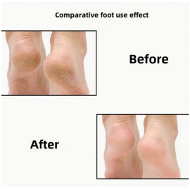 Elektrikli Törpü Ucu - Zımpara Seti 60Adet+Uç